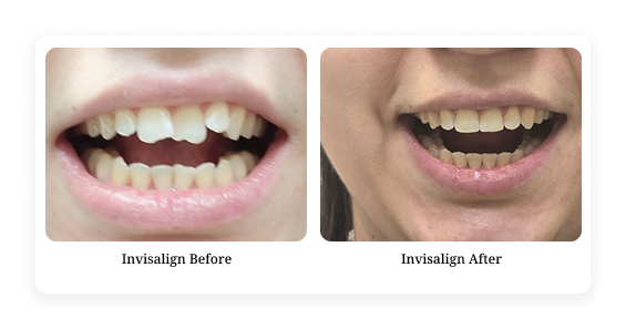 Before & After5